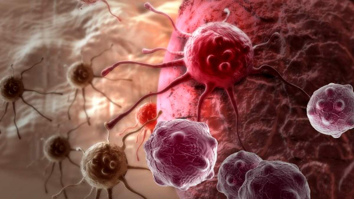 Έλληνας ερευνητής και η ομάδα του κατάφεραν να «σκοτώσουν» τον καρκίνο του μαστού – Έσωσαν γυναίκα στο τελικό στάδιο!