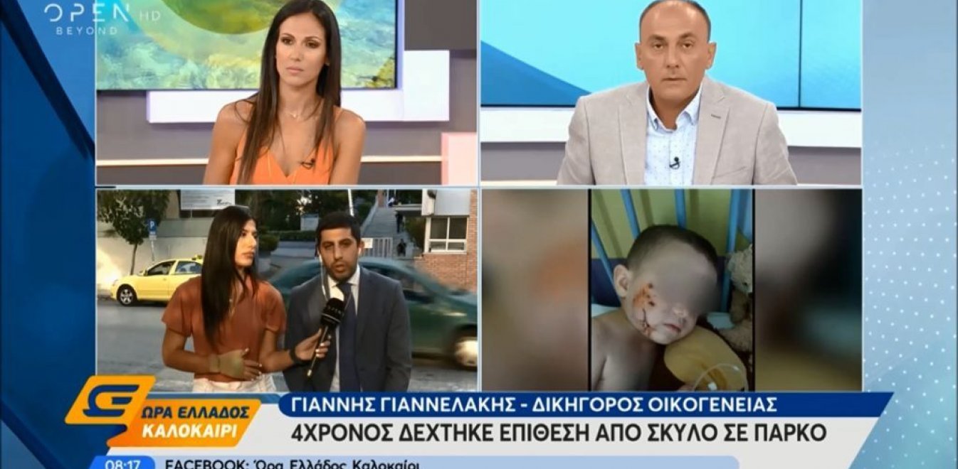 Επίθεση από σκύλο δέχτηκε 4χρονος σε πάρκο – Του έγιναν 16 ράμματα (βίντεο)