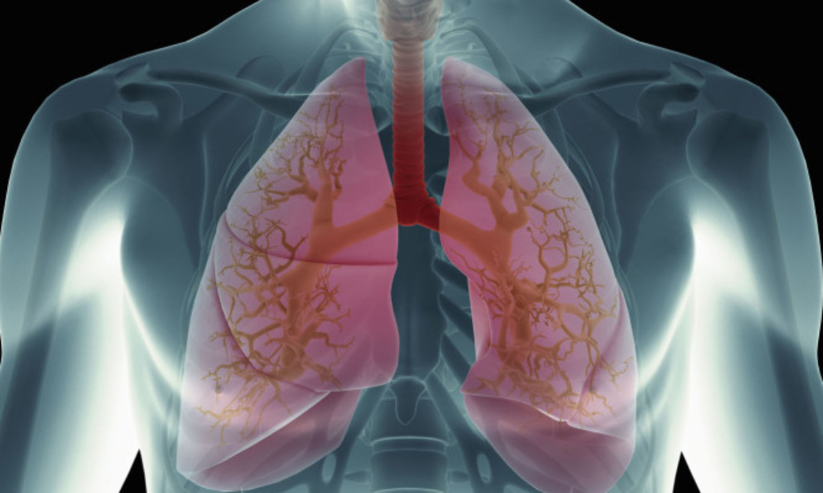 Πνευμονικό οίδημα: Προσοχή στα συμπτώματα – Τι πρέπει να κάνετε άμεσα