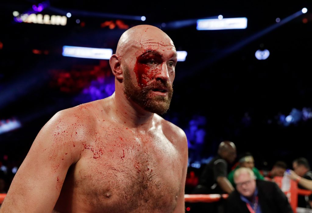 Η άχρηστη πληροφορία της ημέρας: Ο Tyson Fury αυνανίζεται 7 φορές την ημέρα πριν τον αγώνα του (φωτο)