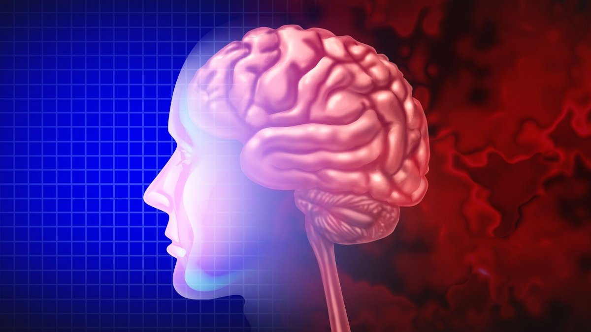 Νέα έρευνα: Το Αλτσχάιμερ μπορεί να μεταδοθεί από άνθρωπο σε άνθρωπο μέσω σπάνιων ιατρικών ατυχημάτων