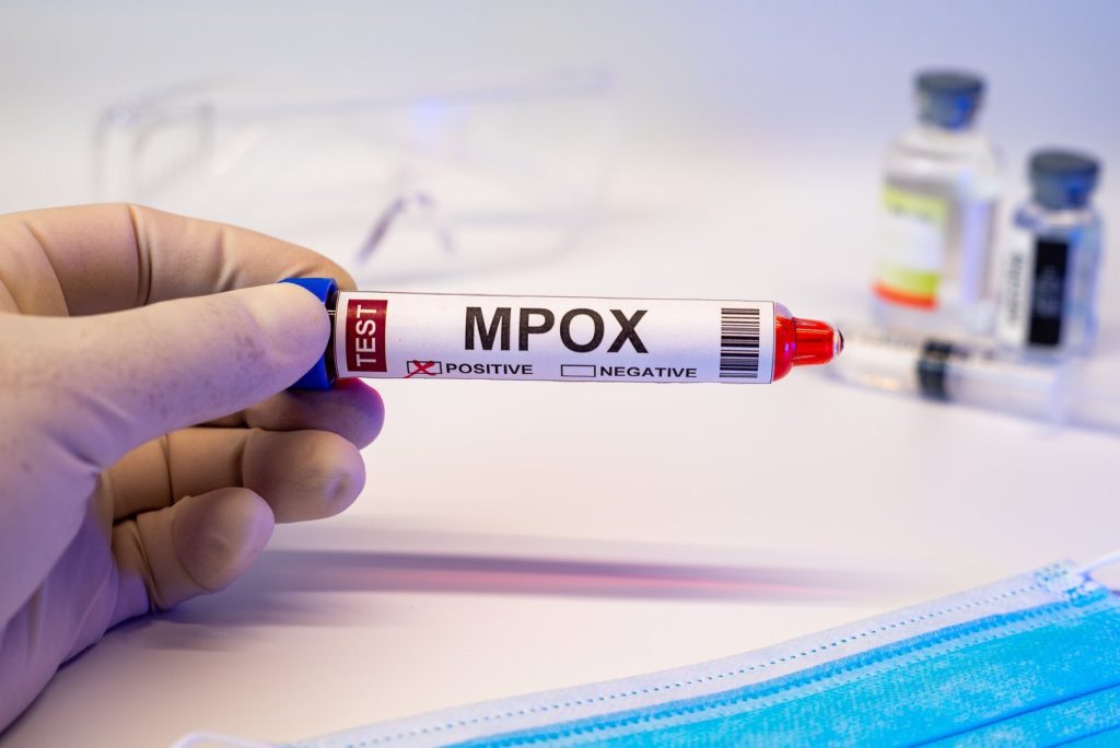 Νέος θάνατος από τον ιό mpox στη Νότια Αφρική – Πώς μεταδίδεται