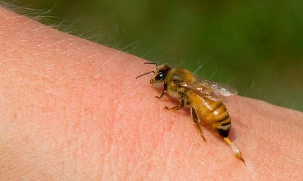 Τσίμπημα μέλισσας: Δείτε τι πρέπει να κάνετε για να το αντιμετωπίσετε