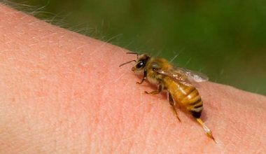 Τσίμπημα μέλισσας: Δείτε τι πρέπει να κάνετε για να το αντιμετωπίσετε