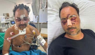 Ξυλοδαρμός Ελληνοκαναδού στην Κρήτη: Τα χτυπήματα θα μπορούσαν να του κοστίσουν τη ζωή
